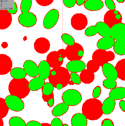 ImageProcessing_MorphologicalFilter_ExampleDilation