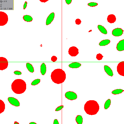 ImageProcessing_MorphologicalFilter_ExampleErosion